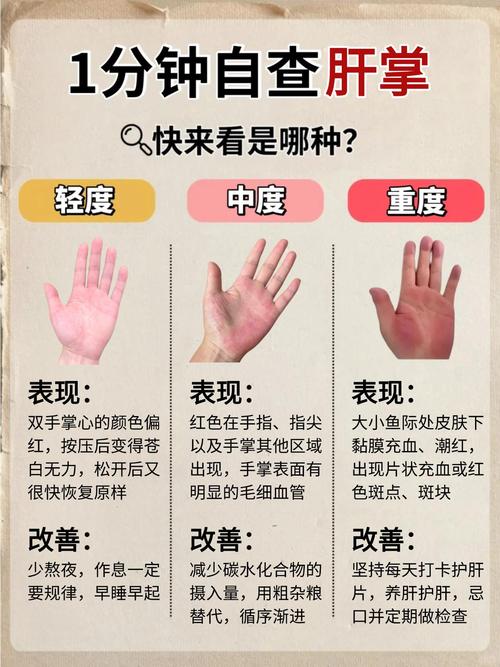 肝脏好不好，看手就知道！一个信号，是肝脏在求救！