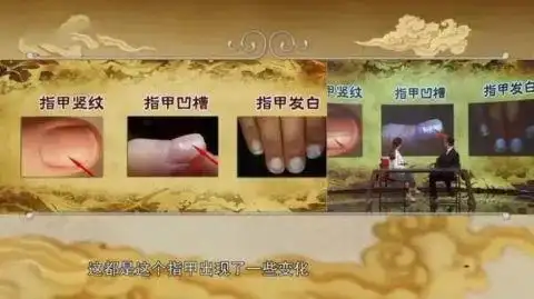 肝脏好不好，看手就知道！一个信号，是肝脏在求救！