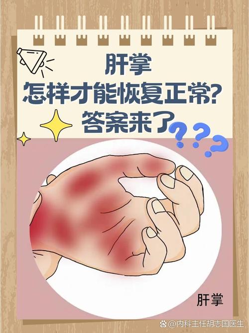 肝脏好不好，看手就知道！一个信号，是肝脏在求救！