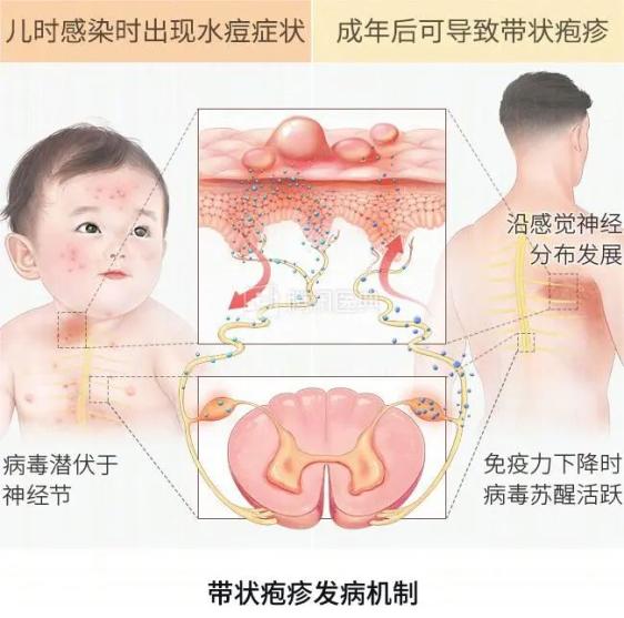 皮肤病千千万，这一种万万不可掉以轻心