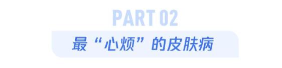 皮肤病千千万，这一种万万不可掉以轻心