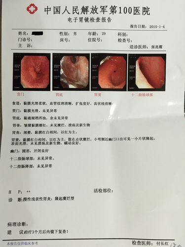 慢性浅表性胃炎