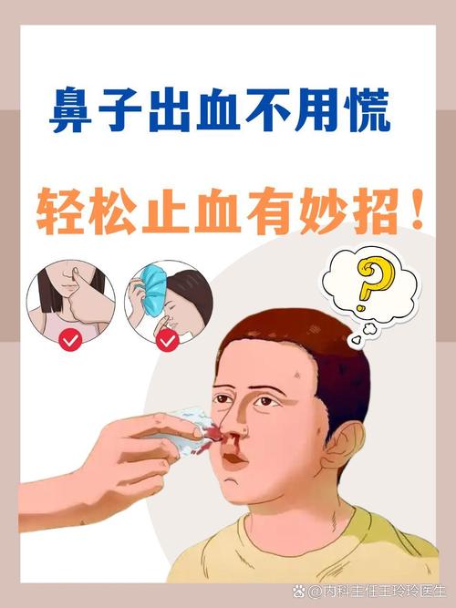一晚接诊10个！流鼻血该仰头还是低头？医生：这个广为流传的姿势会要命