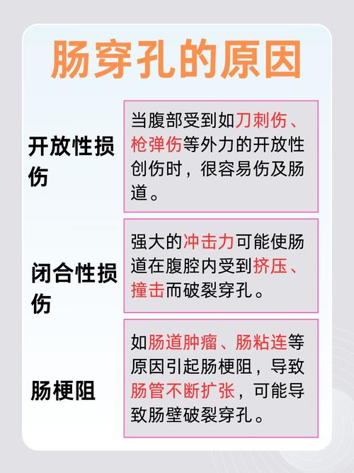 一文读懂非创伤性大肠穿孔：从病因到 CT 诊断