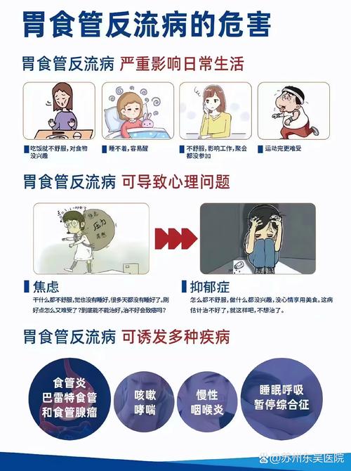 胃食道反流病，干饭人的终极噩梦