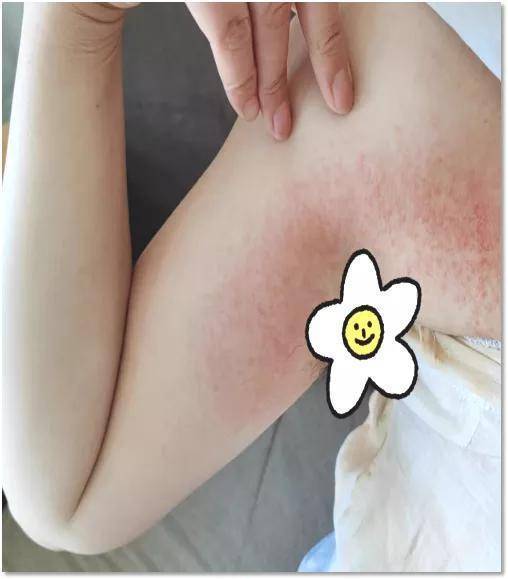 狐臭人群注意了，这几款止汗露慎买！实测20款止汗露，多半有问题
