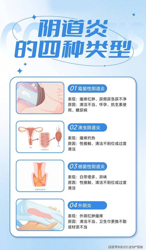 阴道炎怎么预防？女人必知！