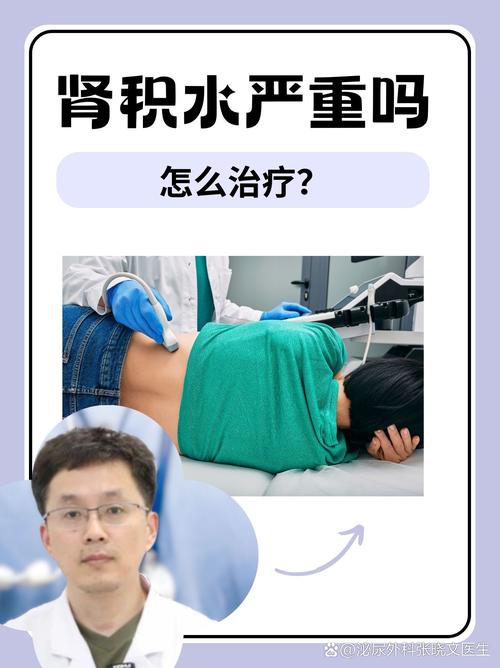 儿童肾积水 不想手术治疗可以吗？