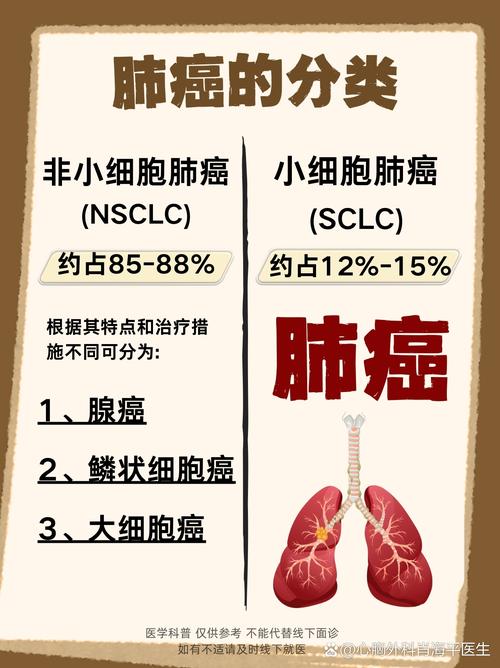 小细胞肺癌恶性程度高，专家呼吁全民戒烟，高风险人群应早筛早诊