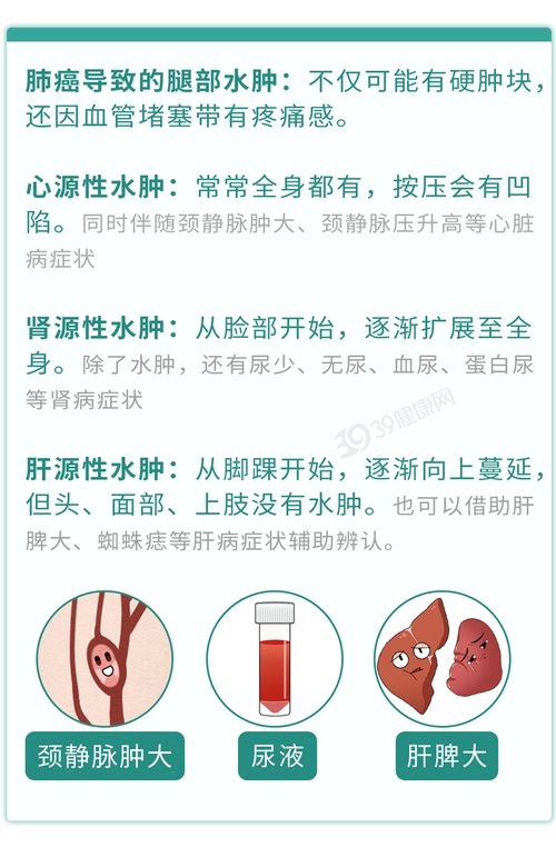 肺癌一查就是晚期？其实双腿早早给了暗示！有 3 个迹象，尽早筛查​