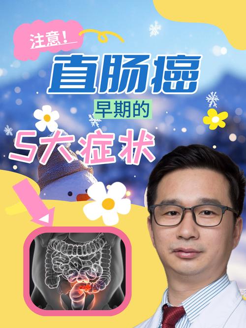 肠癌早期诊断很重要 有这四个症状快就医