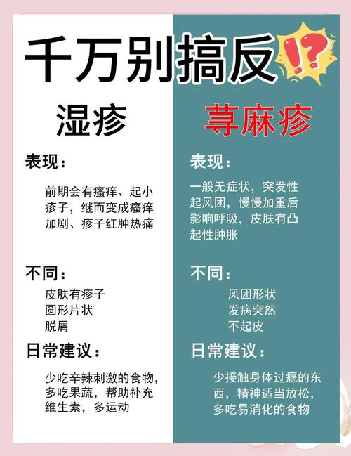 湿疹和荨麻疹的区别是什么 得了荨麻疹怎么办