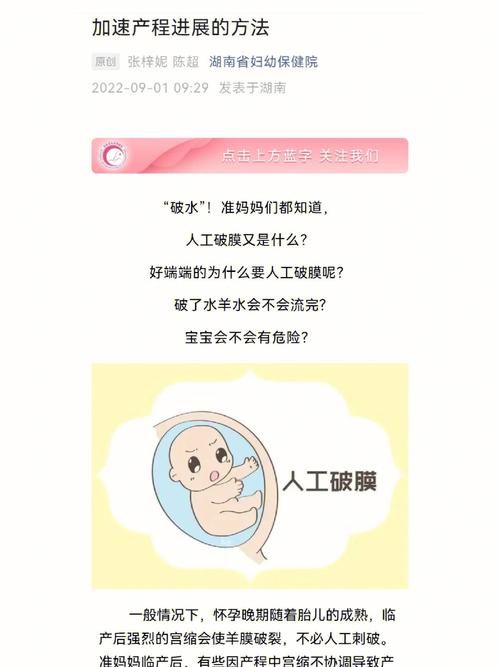 人工破膜——不只是那么简单的一“戳”!