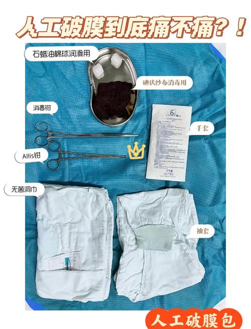 人工破膜手术操作及注意事项