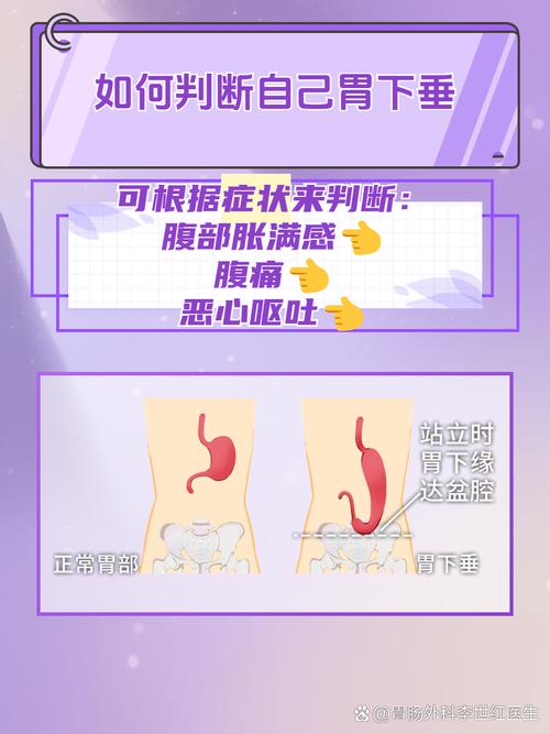 胃下垂能不能治好？