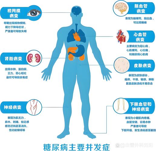 糖尿病的10种并发症